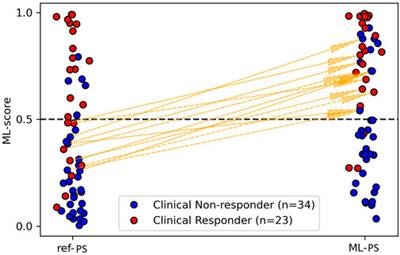 Combination of personalized computational modeling and machine learning for optimization of left ventricular pacing site in cardiac resynchronization therapy